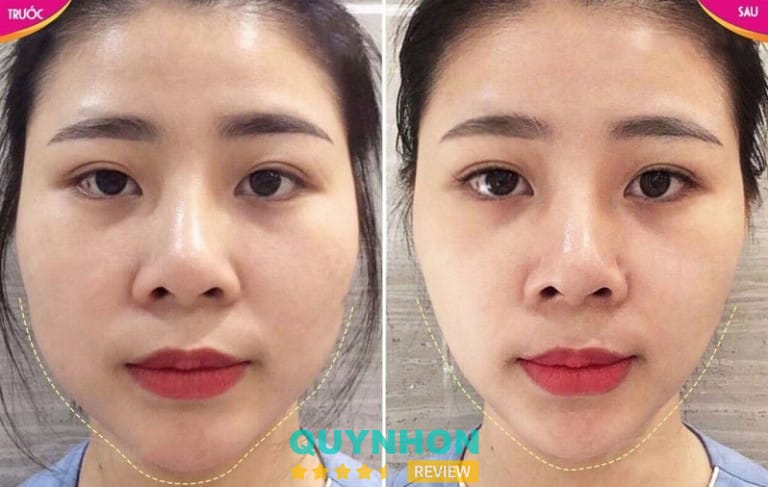 Bằng chứng lâm sàng và nguồn cần tham khảo trước khi quyết định
