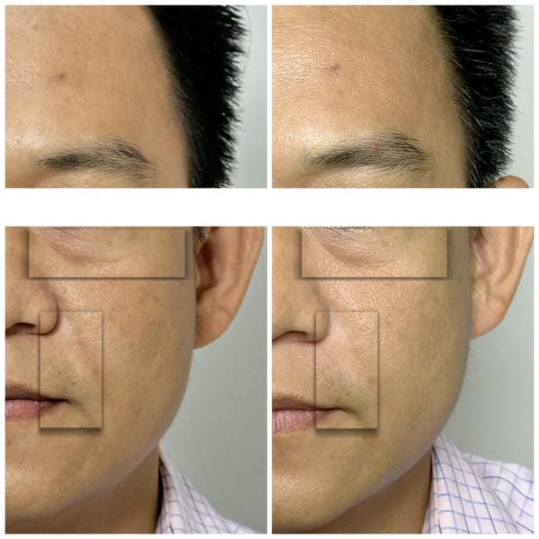 Tiêu chí kỹ thuật để so sánh các phiên bản Stylage