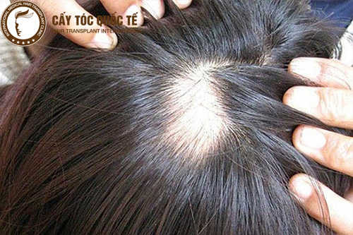 Bằng chứng lâm sàng cho các lựa chọn điều trị — có thể kỳ vọng gì về kết quả?