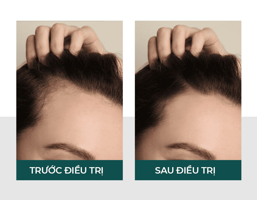 Các bước điều trị thực tế và so sánh nhanh các phương pháp