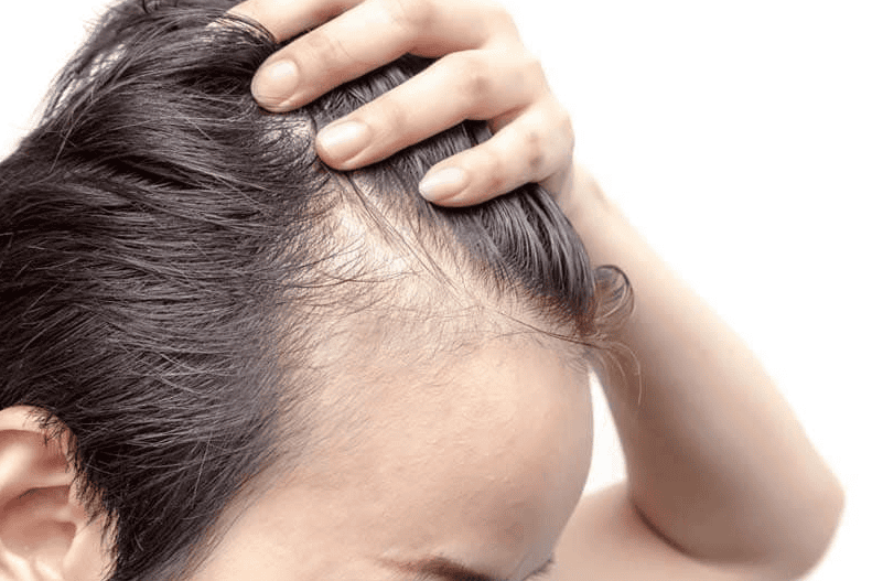 Quy trình chăm sóc nang tóc tại clinic — bước nào nên làm trước, sau và tần suất?