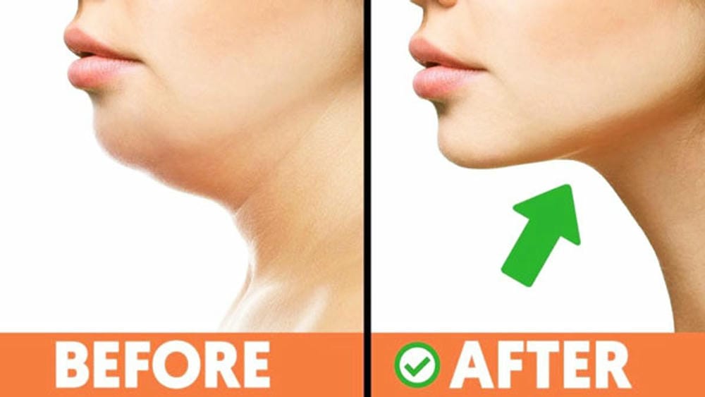 Làm sao để chọn nơi điều trị an toàn và đạt kết quả tự nhiên?