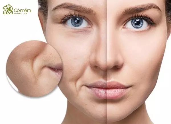 Tại sao rãnh cười càng rõ theo tuổi — có thể ngăn chặn hay đảo ngược được không?