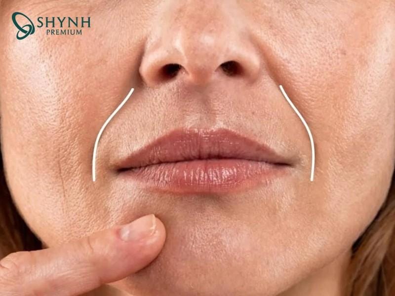 Chăm sóc sau điều trị và các sản phẩm hỗ trợ tăng sinh collagen — có giúp kéo dài hiệu quả không?