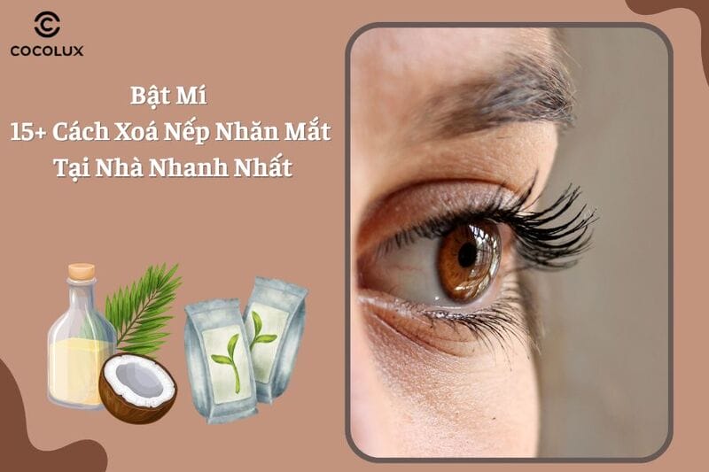 Filler (hyaluronic acid) và sửa khuyết thể tích, filler rãnh lệ
