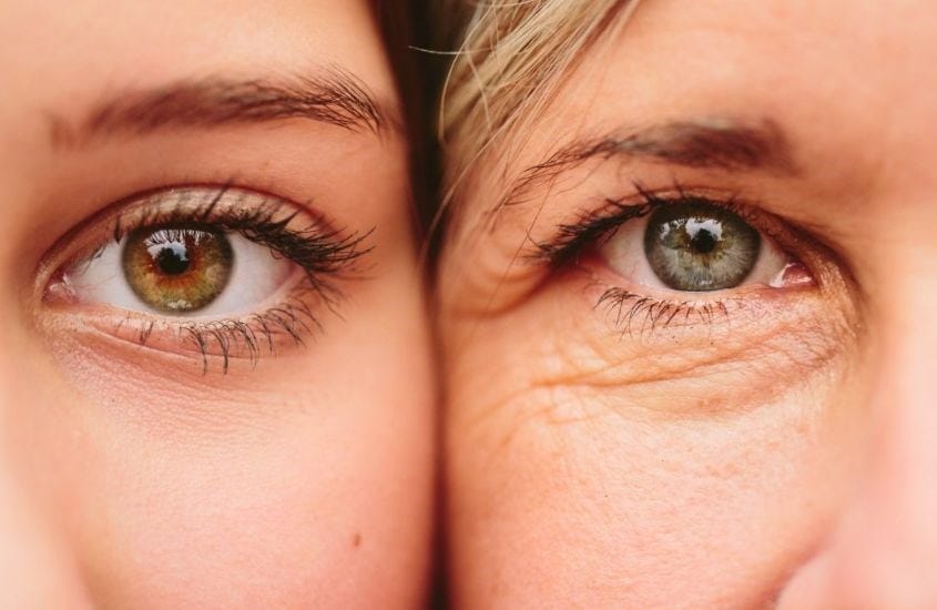 Microneedling kết hợp PRP — có nên thử cho vùng mắt?