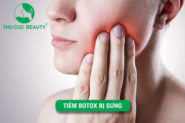 Chăm sóc sau tiêm botox: làm gì để giảm sưng?