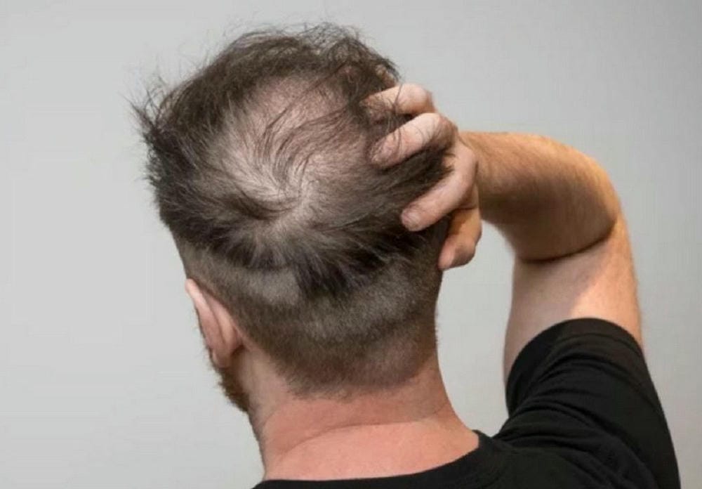 Những rủi ro và tác dụng phụ cần biết trước khi quyết định