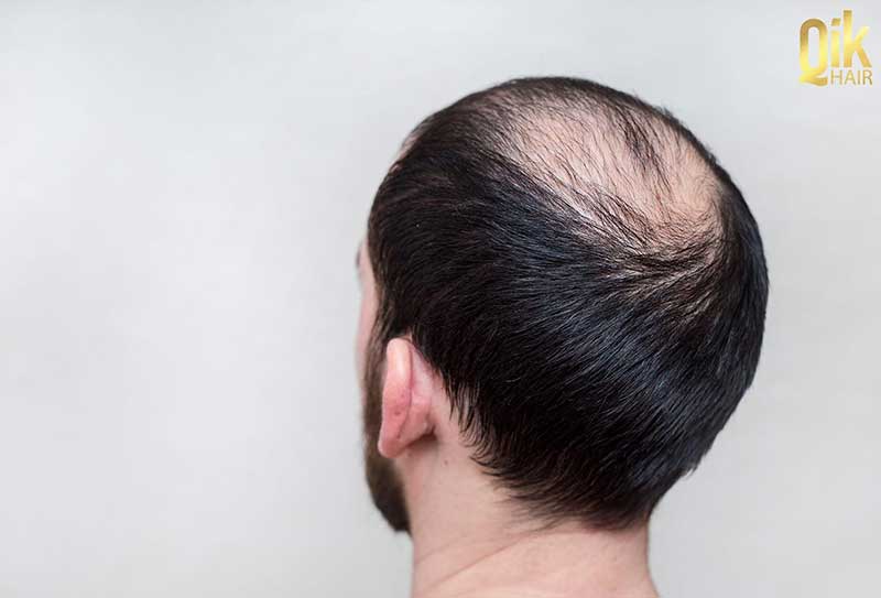 Bằng chứng lâm sàng: Những điều chuyên gia và nghiên cứu nói gì?