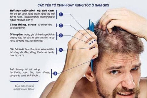 Những dấu hiệu nào cho thấy rụng tóc ở nam giới cần can thiệp y khoa ngay?