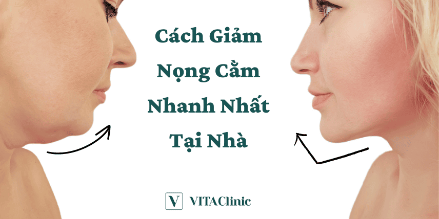 Phương pháp nào phù hợp với bạn — so sánh lợi ích, rủi ro và thời gian hồi phục?