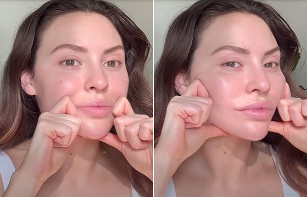 Phẫu thuật độn cằm, gọt cằm: khi nào nên nghĩ đến phương án mổ?