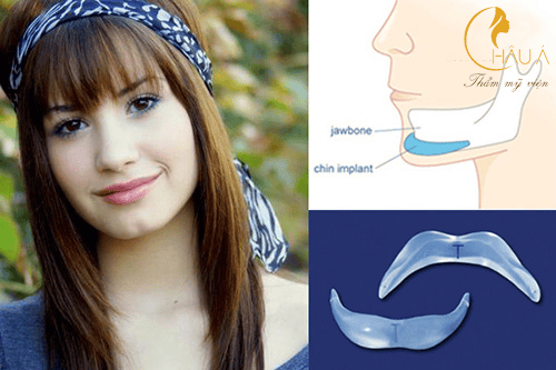 Rủi ro, tác dụng phụ và cách chọn nơi thực hiện