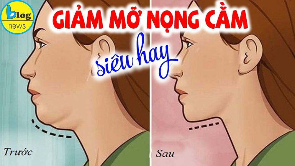 Chăm sóc sau điều trị: những điểm quan trọng không được bỏ qua