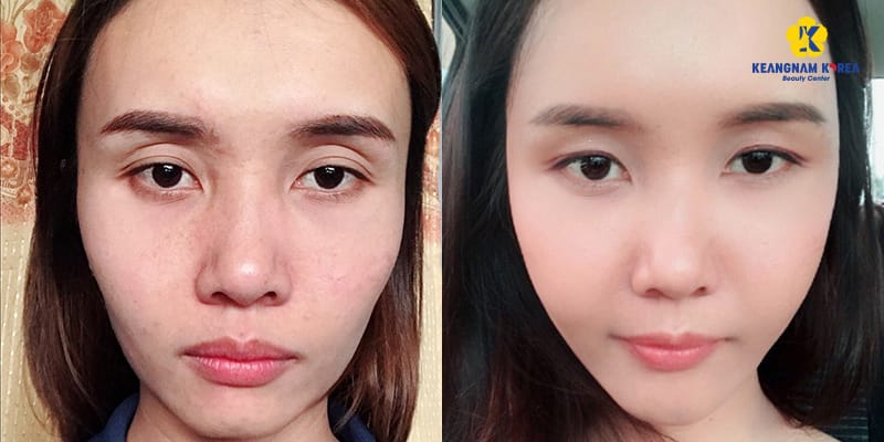 Làm thế nào để giảm rủi ro và đạt kết quả tự nhiên?