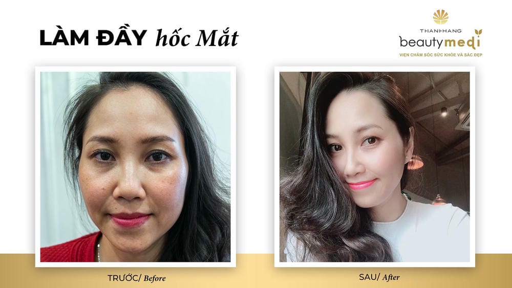 Bằng chứng lâm sàng ngắn gọn để tham khảo
