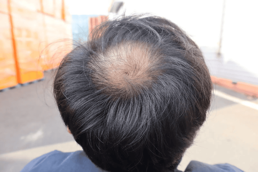 Ai phù hợp với từng nhóm phương pháp?