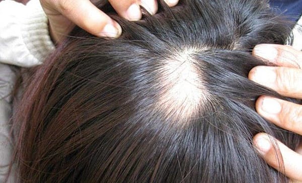 Làm sao để chọn nơi điều trị uy tín và tiêu chí an toàn?