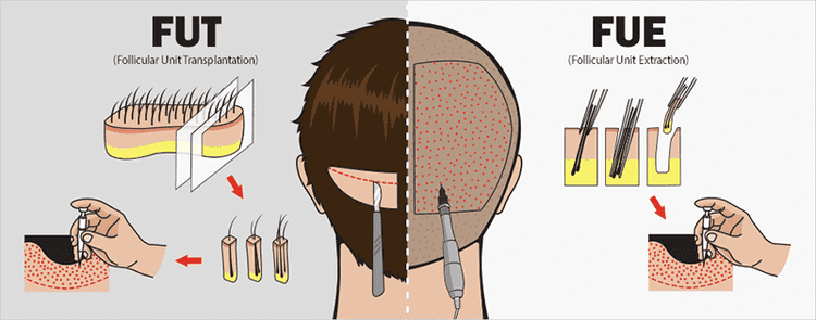 Quy trình khám và điều trị chuẩn tại cơ sở y tế chuyên nghiệp như Lona Skin Lab là gì?