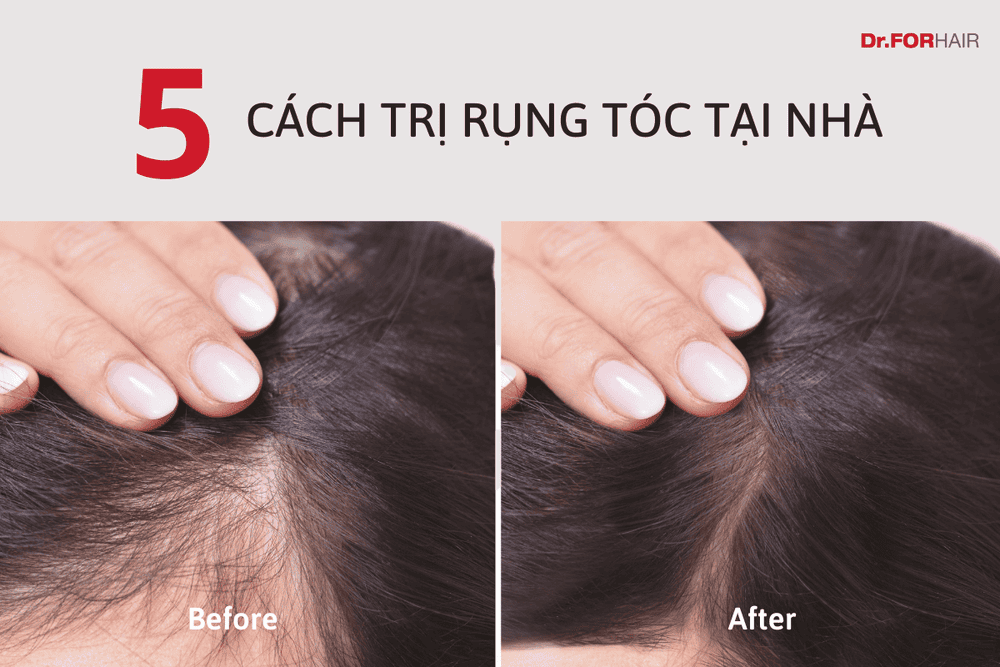Bao lâu thì thấy thay đổi và làm sao để duy trì kết quả?