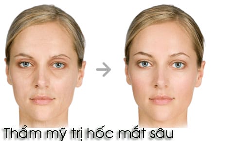 Nguy cơ, tác dụng phụ và khi nào nên hoãn điều trị?