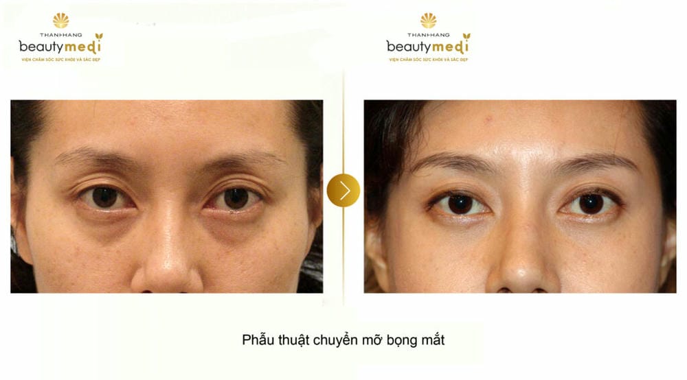 Bằng chứng lâm sàng: phương pháp nào được nghiên cứu nhiều nhất?