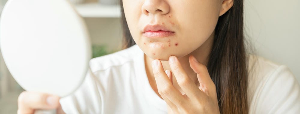 Quy trình điều trị mẫu tại clinic — cần kỳ vọng như thế nào?