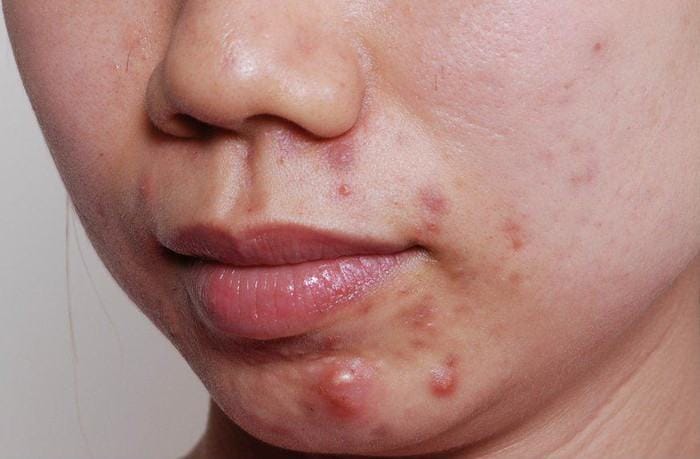 Chăm sóc tại nhà: được phép và cần tránh