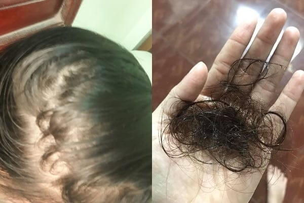 Lời khuyên thực tế để quản lý rụng tóc sau sinh tại nhà hàng ngày
