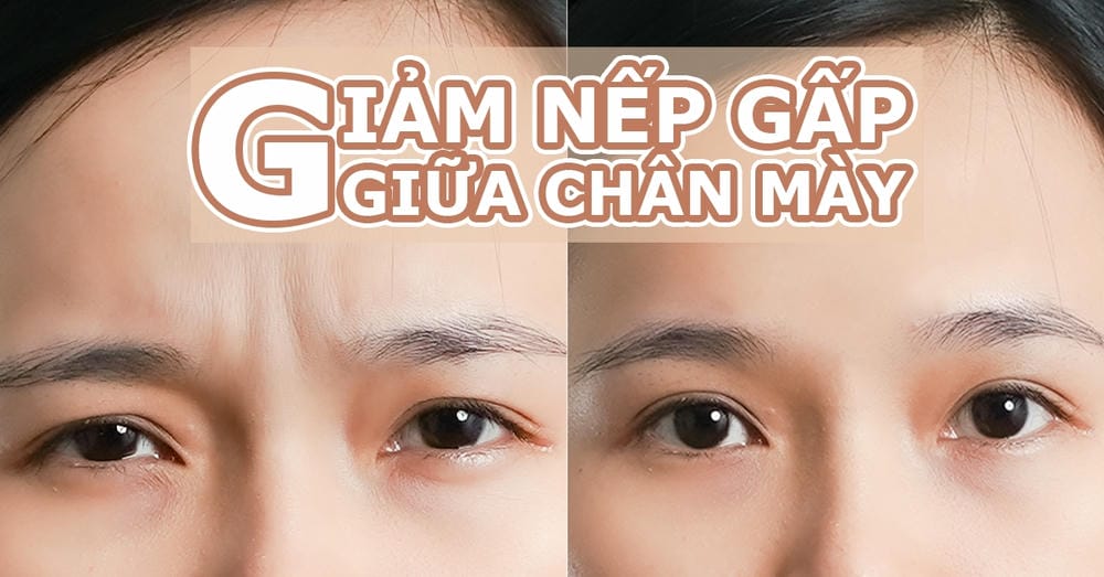 Rủi ro, tác dụng phụ thường gặp và cách xử trí