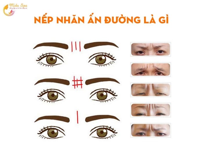 Một số câu hỏi thực tế mà khách hàng thường băn khoăn
