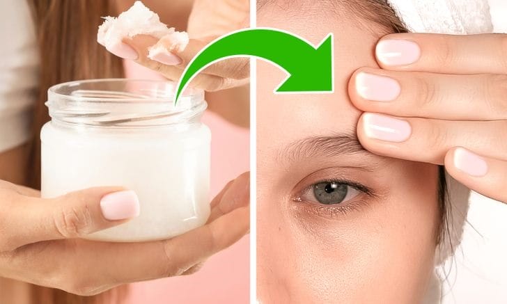 Lifestyle và yếu tố hỗ trợ