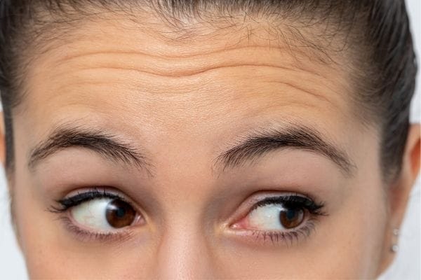 Khi nào cần gặp bác sĩ da liễu hoặc đến clinic thay vì tự điều trị tại nhà?