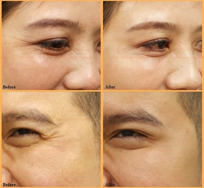 Bằng chứng lâm sàng ủng hộ hiệu quả