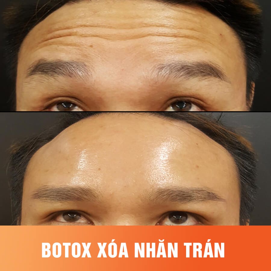 Sẵn sàng quyết định? Lời khuyên thực tế trước khi đặt lịch