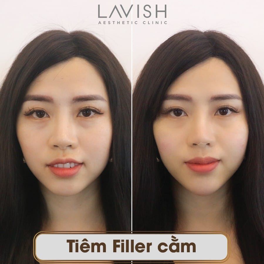 Những câu hỏi thường gặp khách hàng hay hỏi trước khi làm