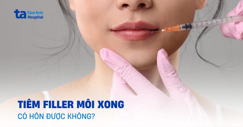 Filler môi an toàn: Kết quả có tự nhiên không?