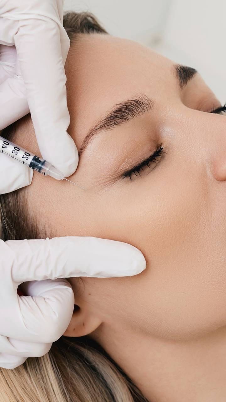 Filler thái dương tác dụng ra sao — đâu là cơ chế làm đầy và tạo dáng?
