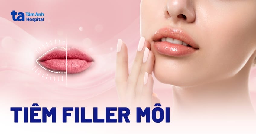 Tiêm filler môi hoạt động thế nào và filler HA thường dùng?