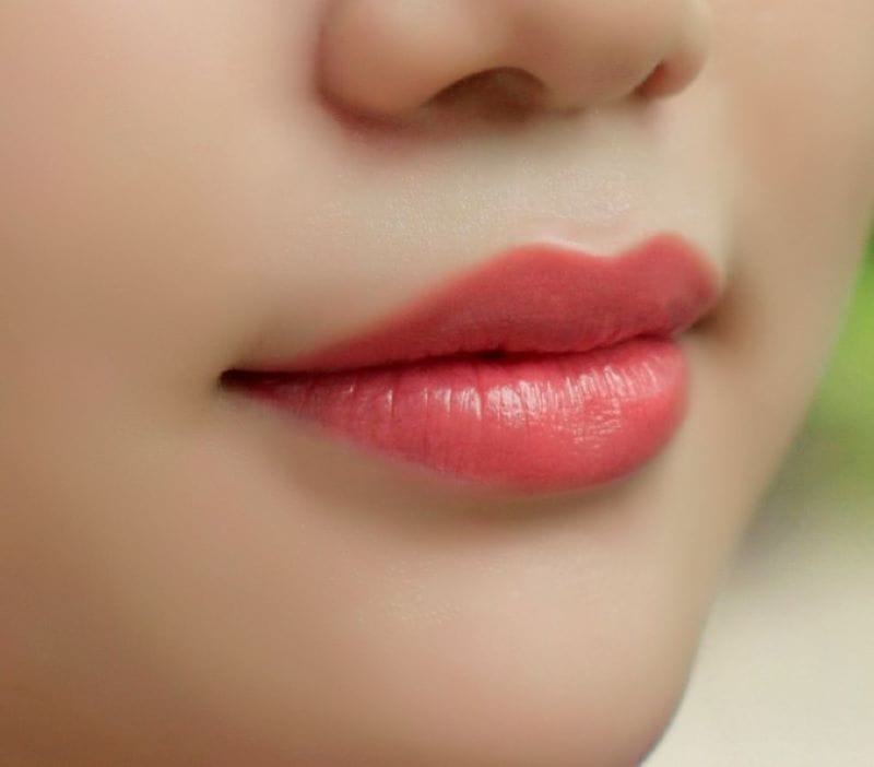 Giảm rủi ro trước và sau quy trình tiêm môi bằng cách nào?