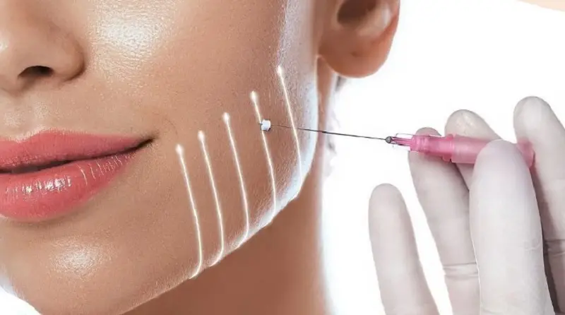Ai nên và không nên làm căng chỉ collagen?