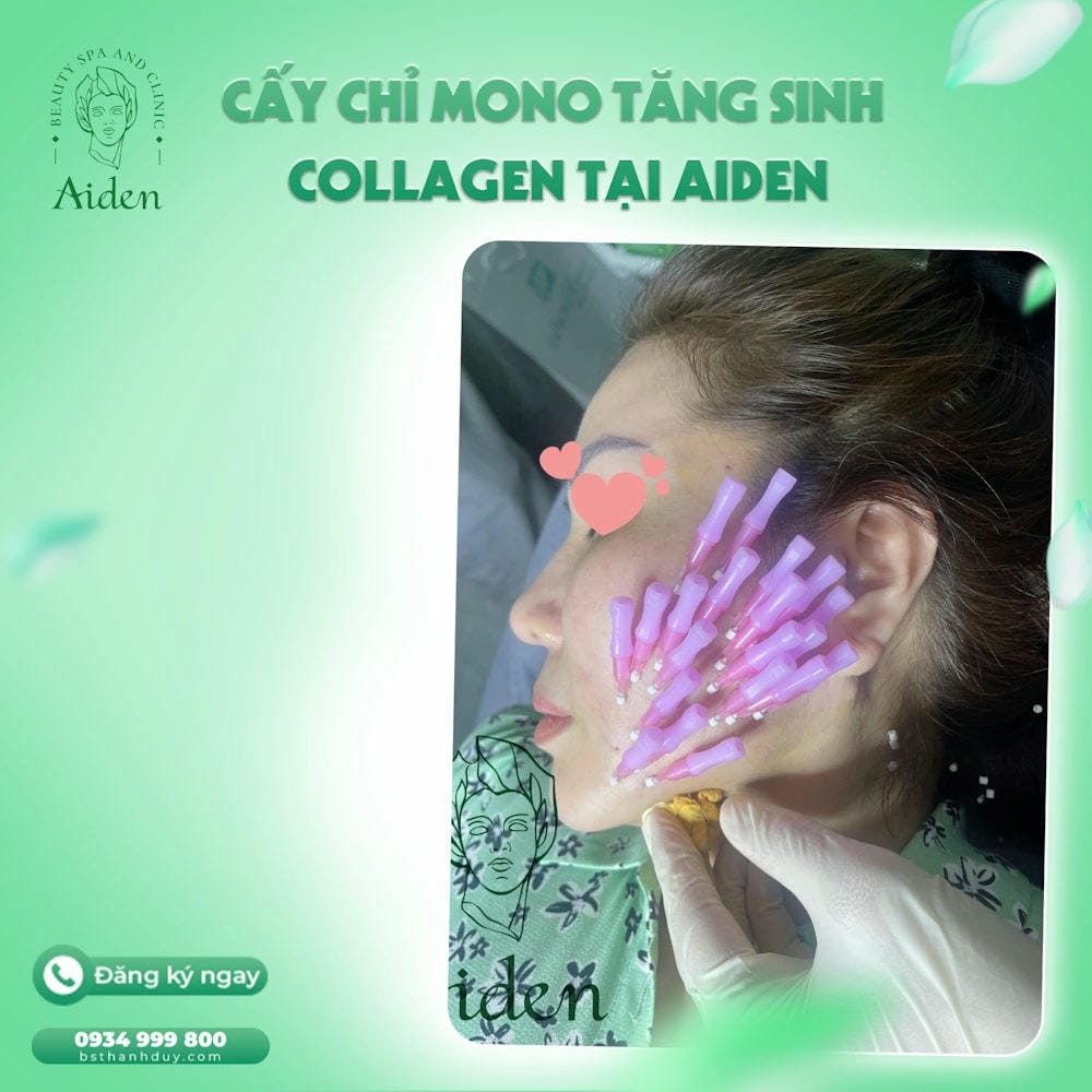 Căng chỉ có để lại sẹo hay vĩnh viễn trên da không?