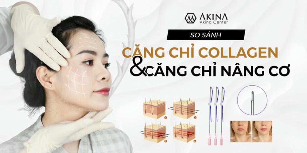 Bước tiếp theo nếu đang cân nhắc làm căng chỉ collagen là gì?