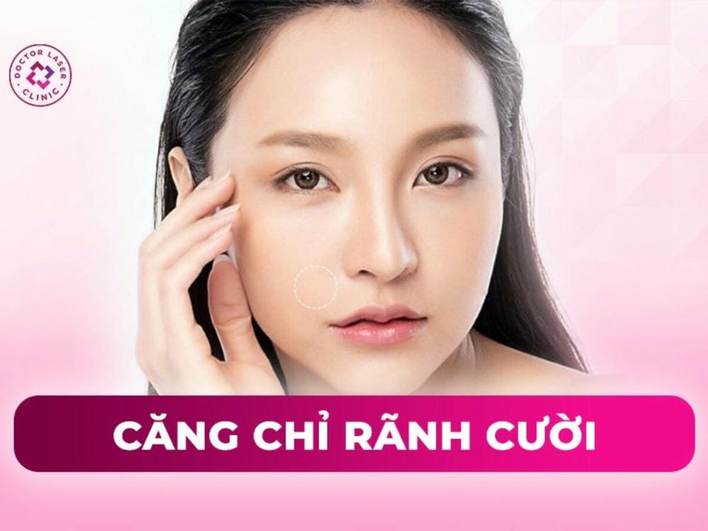 Chi phí có nên là yếu tố quyết định duy nhất?