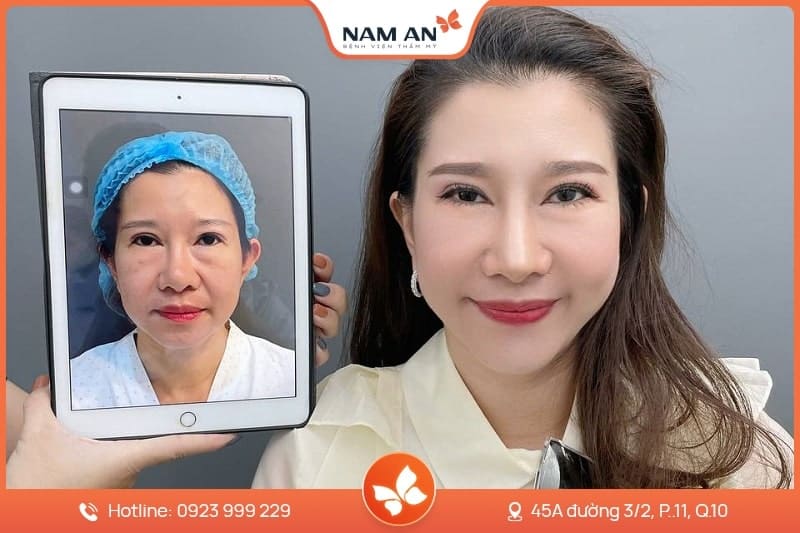 Những tiêu chí cần kiểm tra khi chọn nơi thực hiện để giảm rủi ro và đạt kết quả tự nhiên