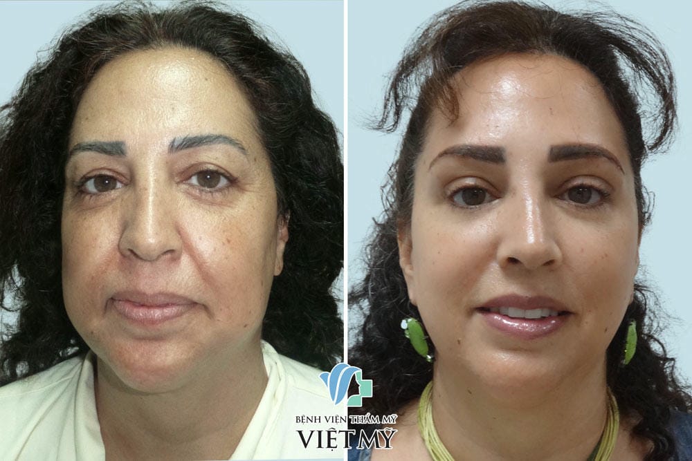 Làm sao để đặt câu hỏi đúng khi tư vấn tiền phẫu?