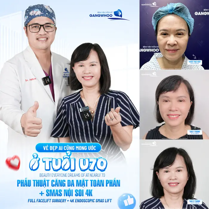 Phương pháp căng da mặt phù hợp — cơ chế tác động từ phẫu thuật, căng chỉ đến HIFU Ultherapy