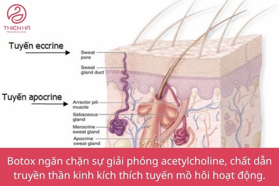 Quy trình tiêm botox cho mồ hôi tay thực hiện như thế nào — có đau không và cần chuẩn bị gì?