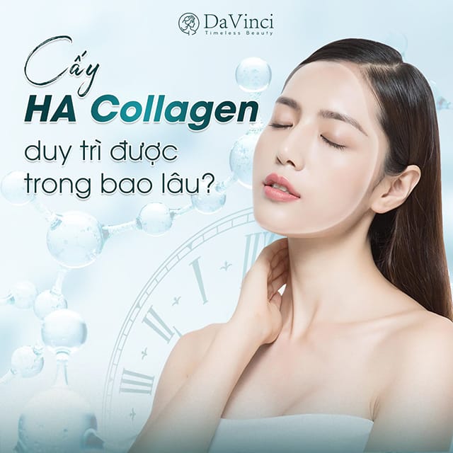 Cấy HA collagen là gì và vì sao nhiều nơi gọi chung tên như vậy?