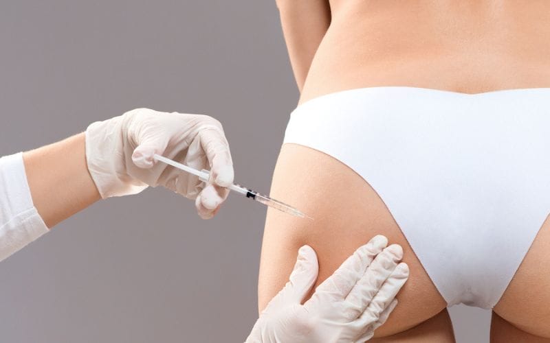 Chi phí cấy HA mông: yếu tố ảnh hưởng